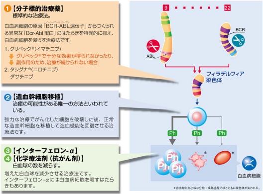 慢性骨髄性白血病の症状